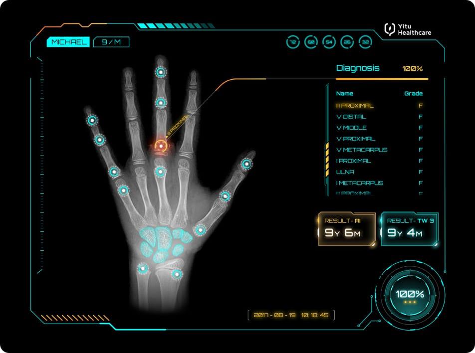 care.aiTM 兒童生長(zhǎng)發(fā)育智能診斷系統(tǒng)